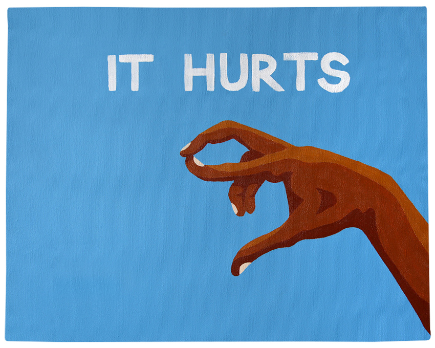 hurts